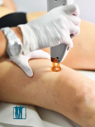 Depilaci�n laser - Foto 3